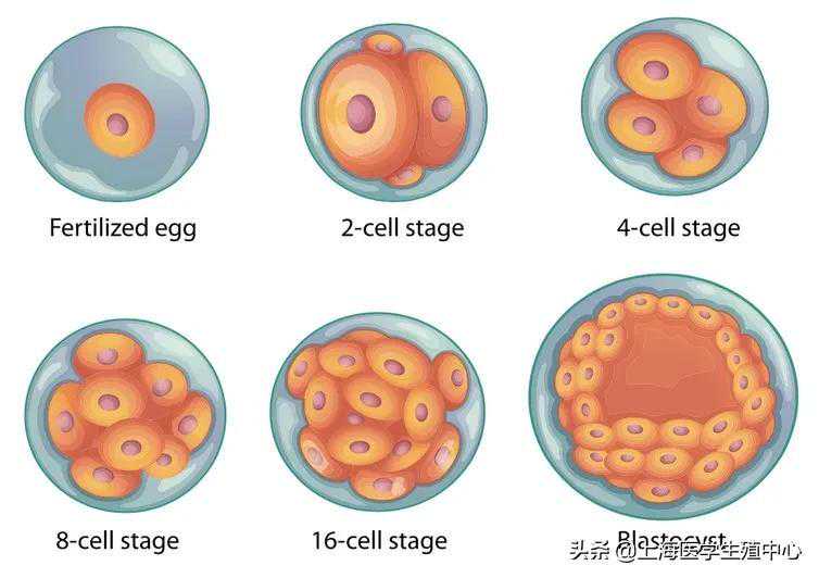 试管婴儿移植一个好，还是两个好？