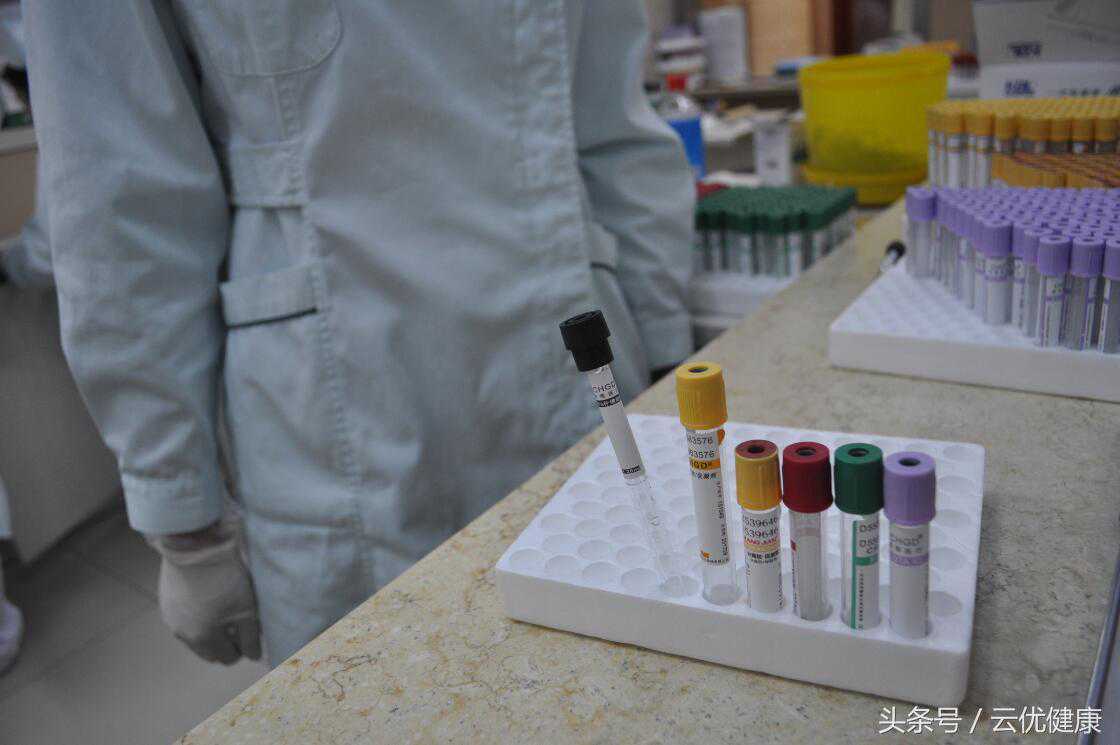 抽血在平常不过的事情，可你知道抽血的试管不同的颜色代表的不同意义么？