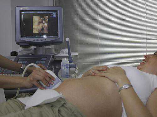 谣言：备孕的时候绝对不能做X光检查？